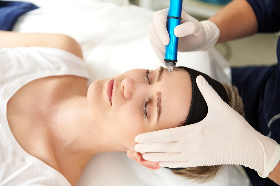 RF microneedling
